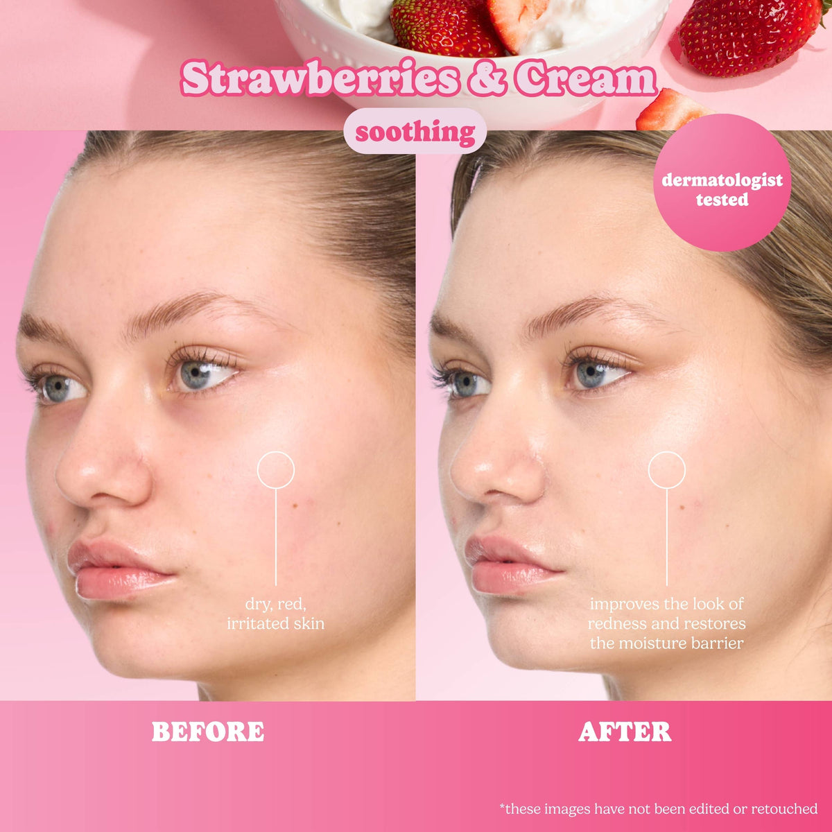 Bye Bye Breakouts Face Mask Kit